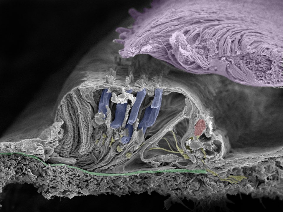 волосковые клетки улитки внутреннего уха